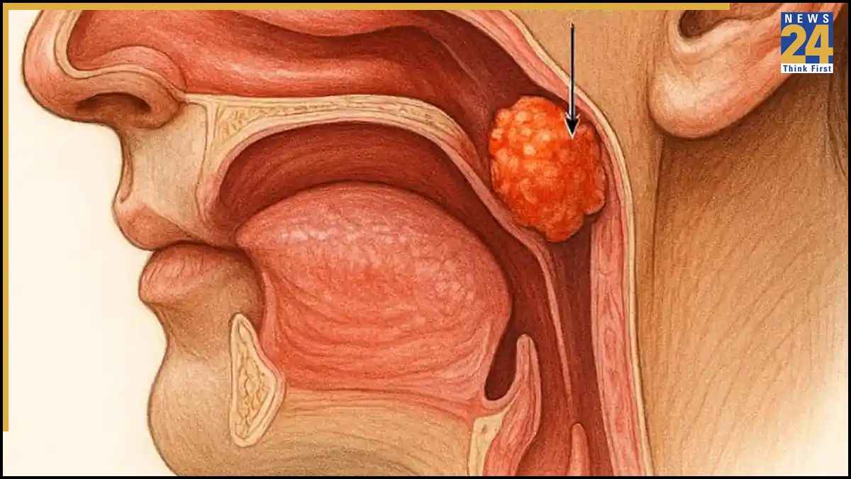 dry throat remedies