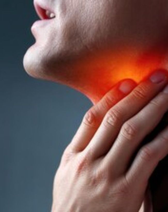 dry throat remedies-1-2-3-4-5