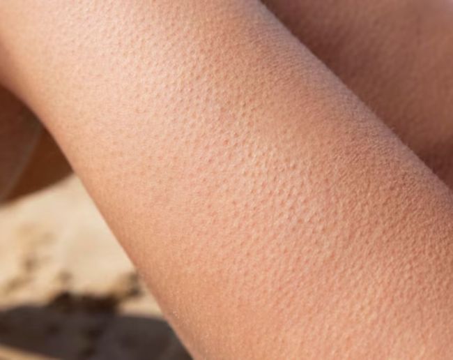 Why do we get goosebumps-1-2-3-4
