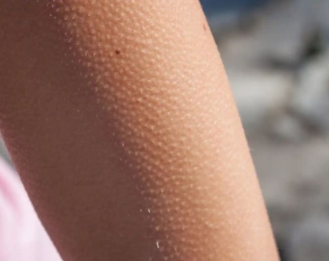 Why do we get goosebumps-1-2-3-4-5