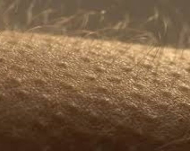 Why do we get goosebumps-1-2-3-4-5-6