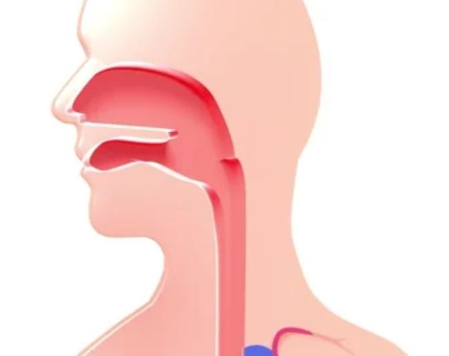 Throat Cancer Signs-1-2-3