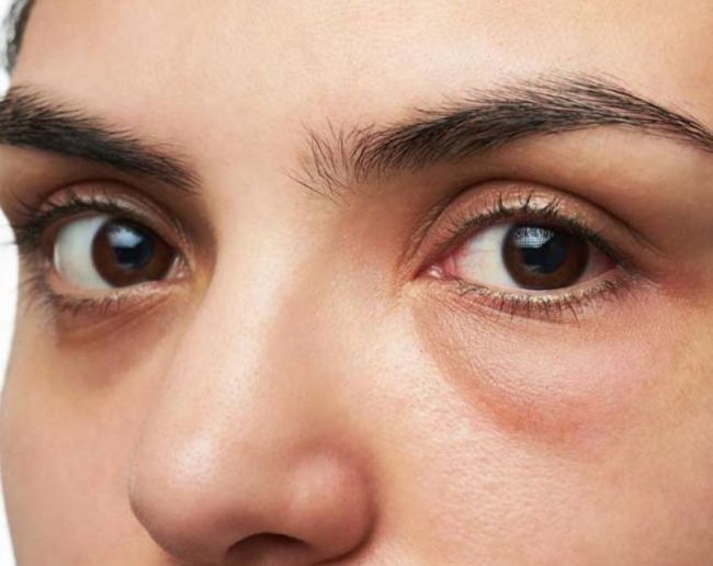 kidney damage reversal-1-2-3