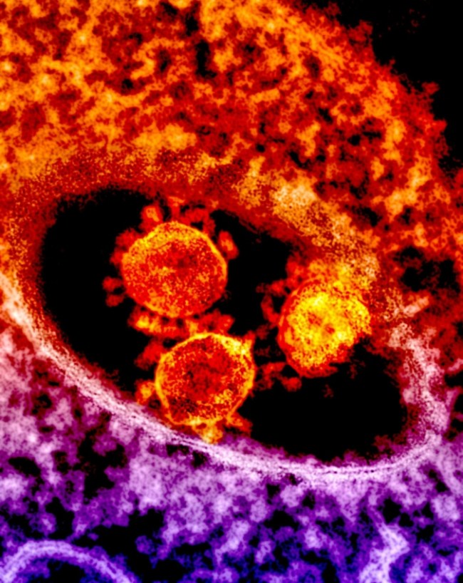 HIV AIDS Risk Male Vs Female-1-2-3