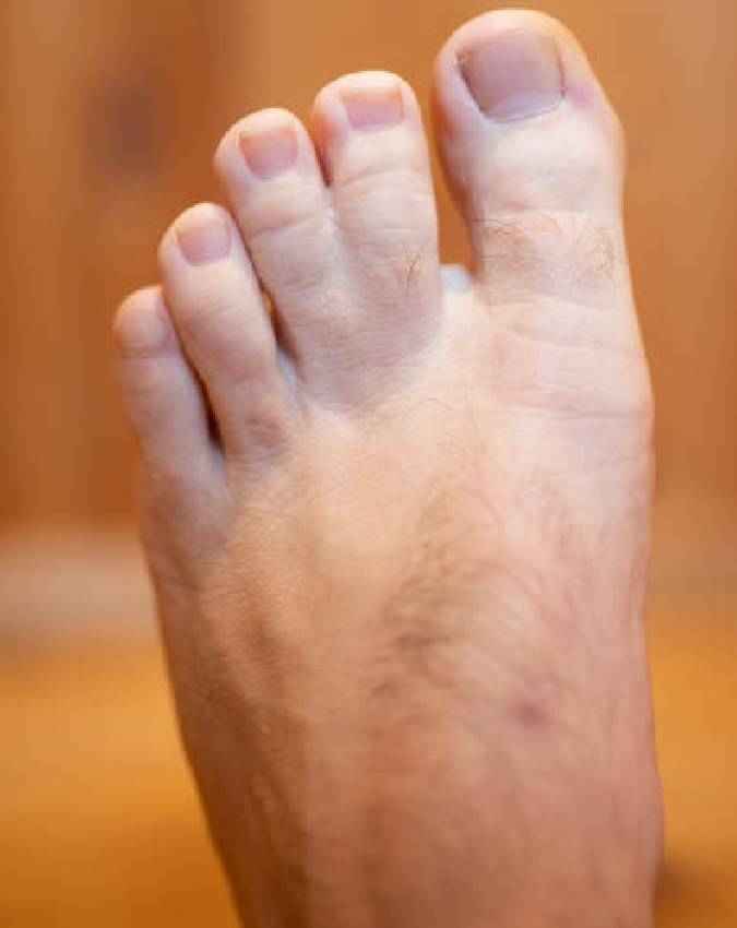 पैरों की उंगलियों से समझें रिश्तों की परतें