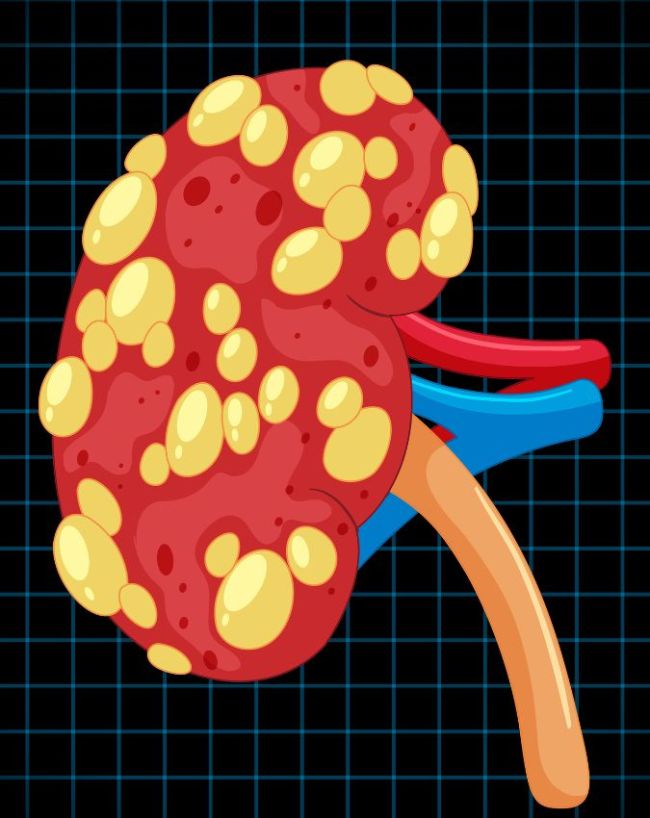 Bitter Taste In Mouth Reason-1-2-3-4