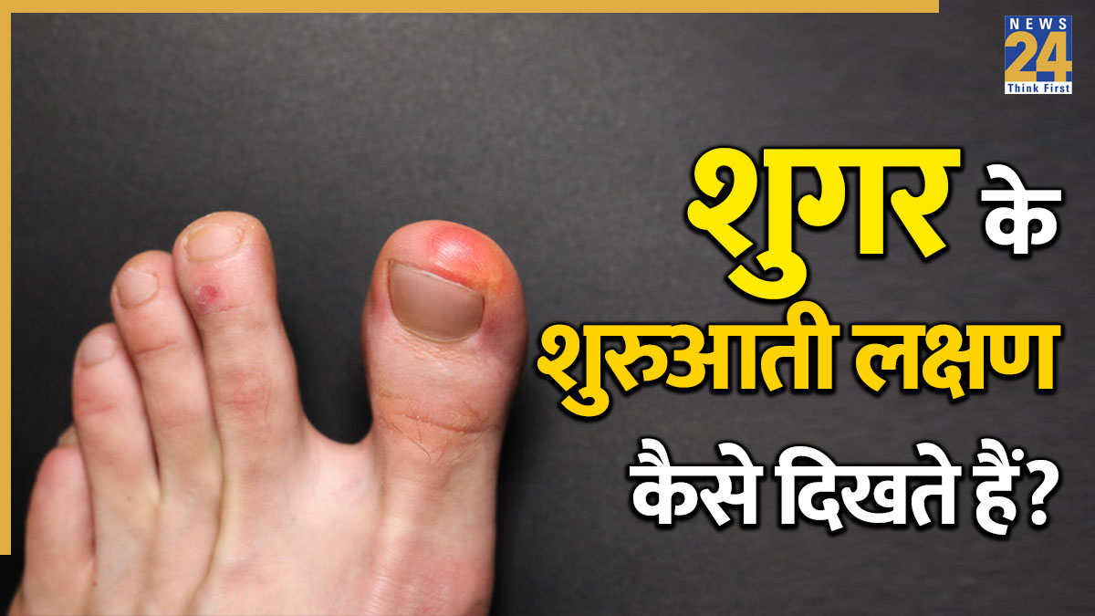 Diabetes ke lakshan-1