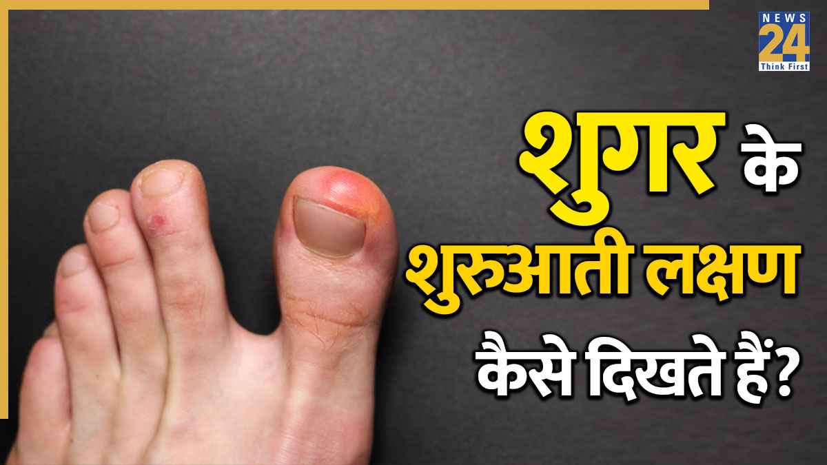 Diabetes ke lakshan