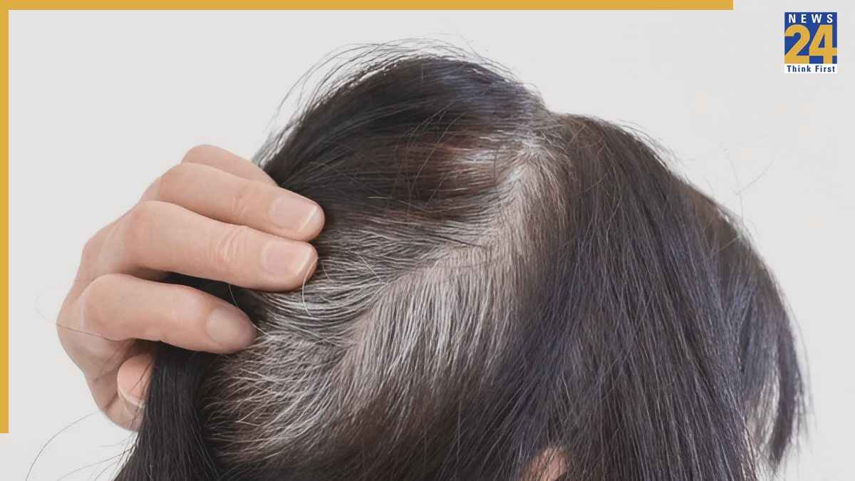 Vitamin Deficiency White Hair