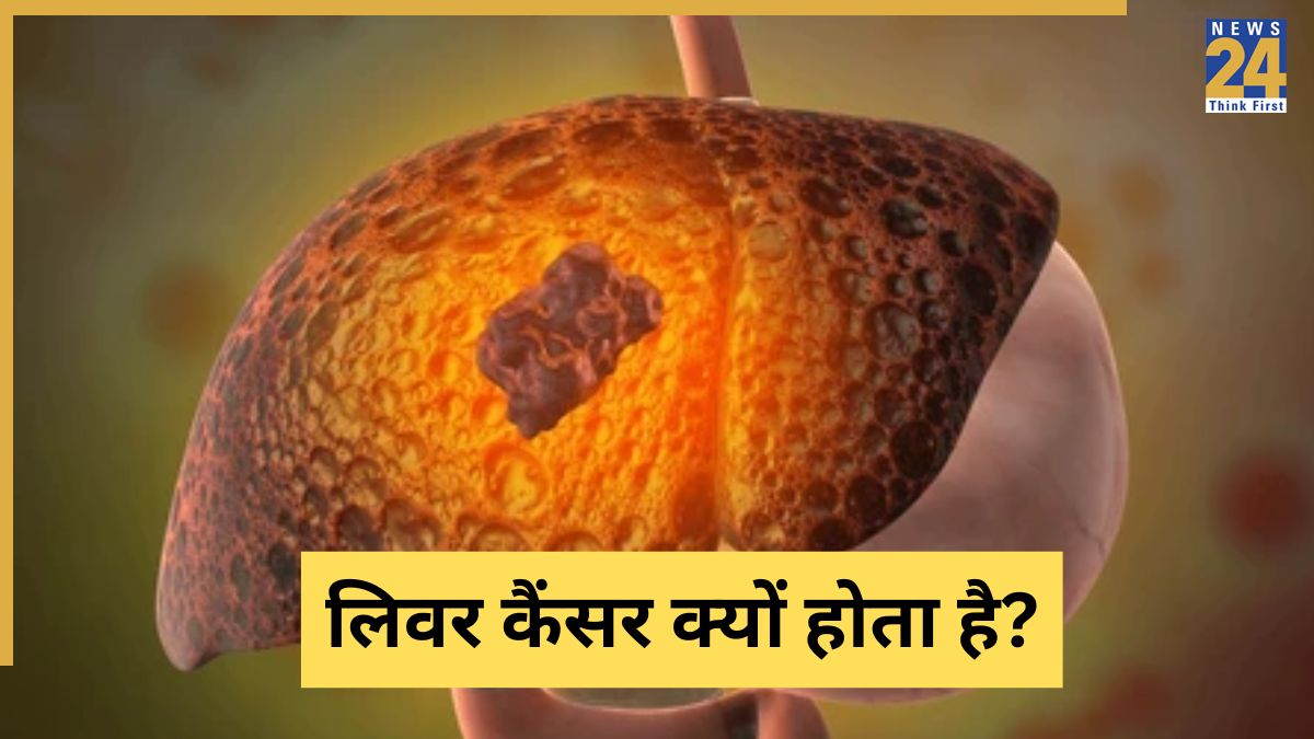 liver cancer disease last stage liver cancer disease last stage-1