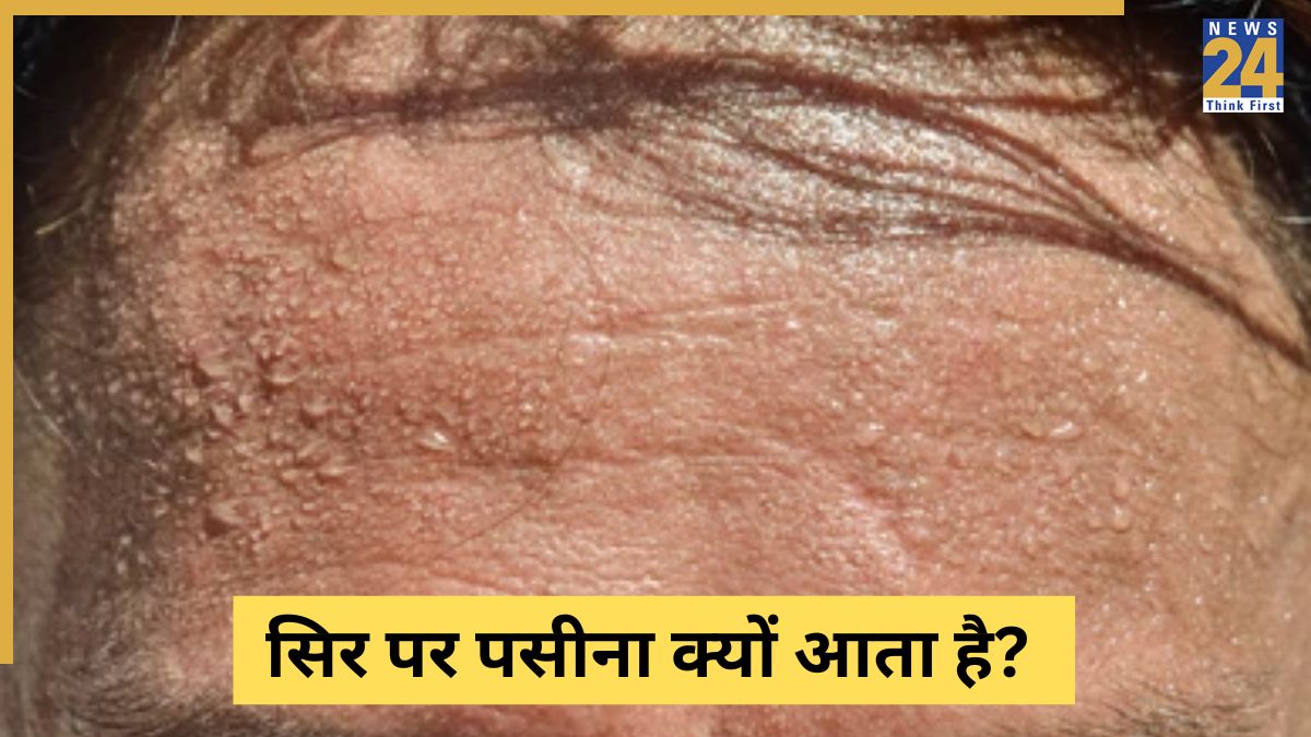 सिर पर पसीWhy Does My Forehead Sweat So Muchना क्यों आता है Why Does My Forehead Sweat So Much-1