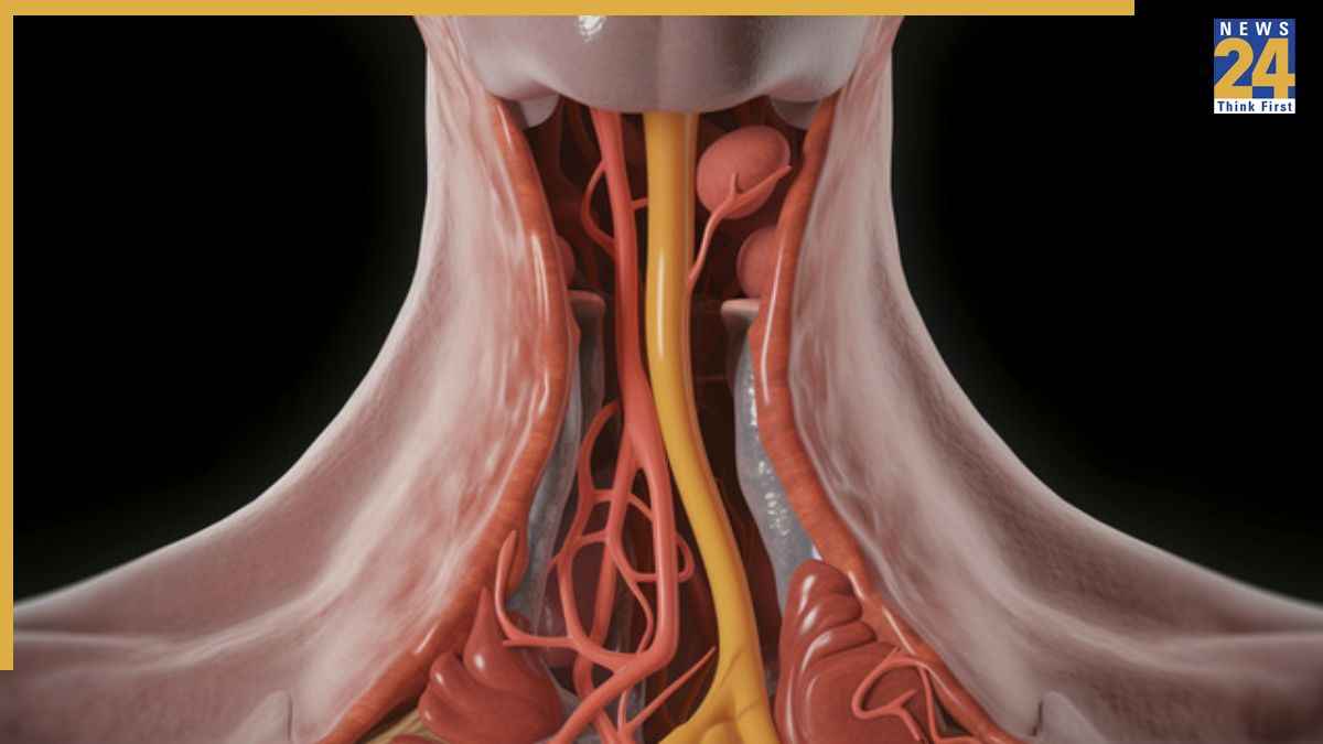 Sore Throat