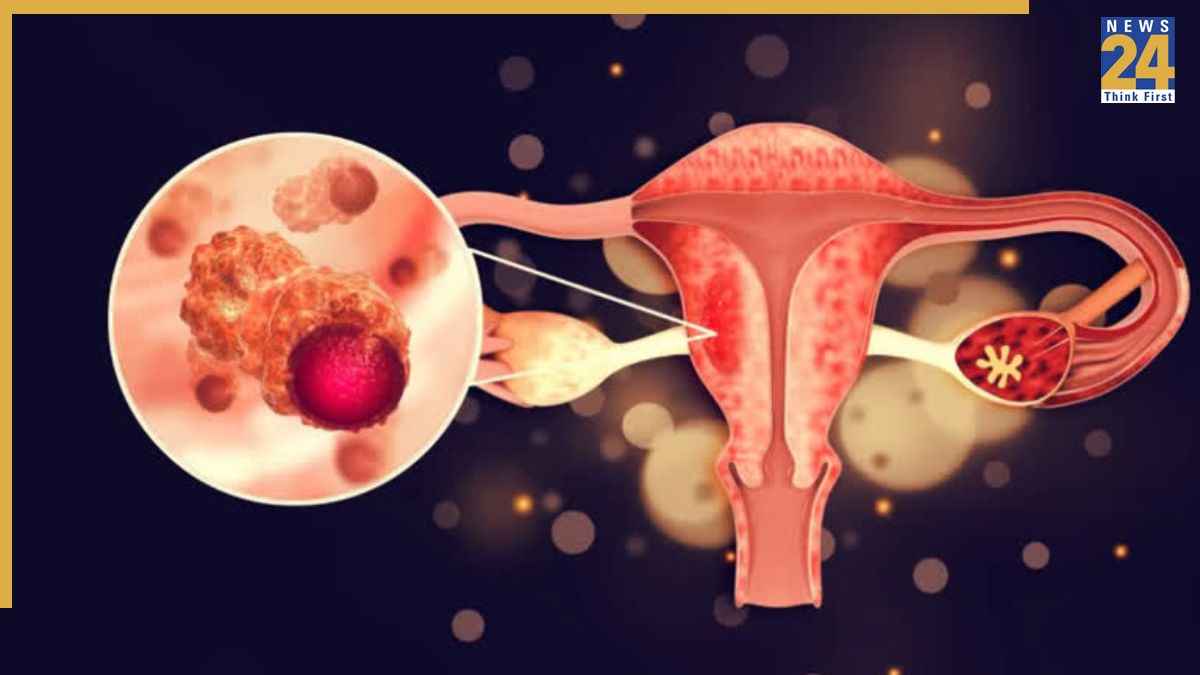 डियर लेडीज! आपके सैनिटरी पैड में छुपा है ये खतरनाक केमिकल, हो सकता है Ovarian Cancer