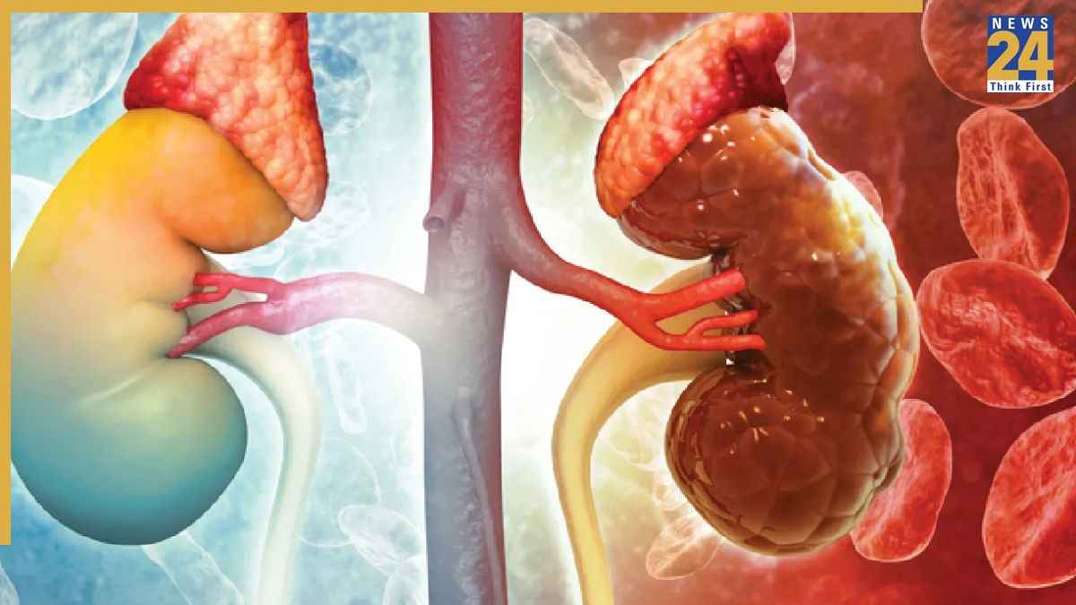 Kidney Disease: 80% लोग रोज कर रहे हैं किडनी का मर्डर, आप भी ये 5 आदतें आज ही छोड़ दीजिए
