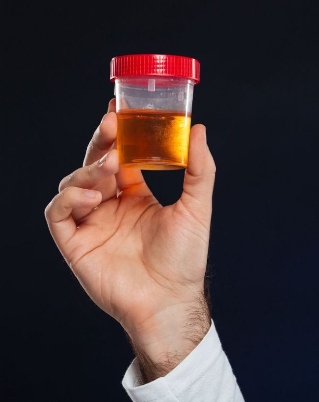 Bladder Cancer Causes-1-2