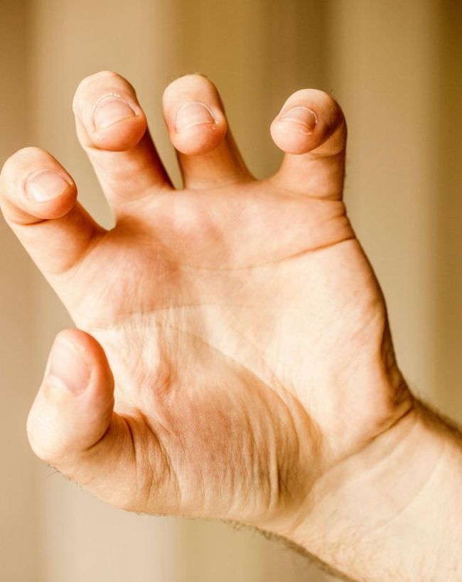 Itchy Palm liver disease-1-2-3-4