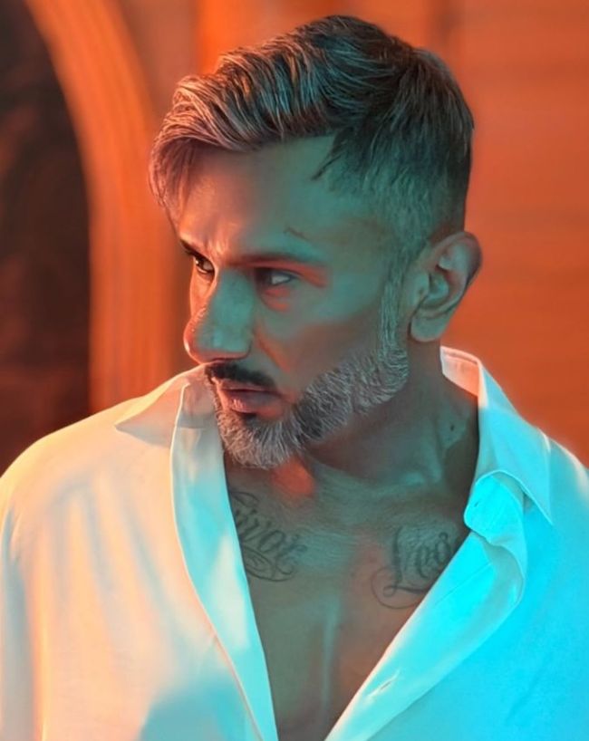 honey singh bald-1-2