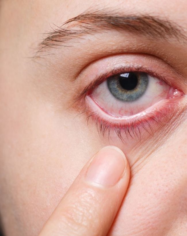 Early signs of anemia-1-2-3-4-5-6-7