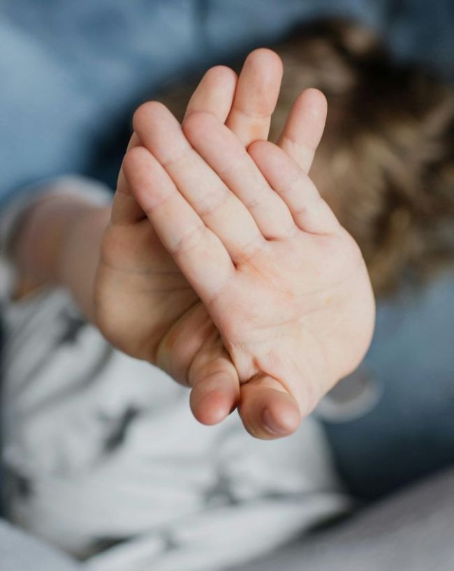 Itchy Palm liver disease-1-2-3-4-5-6