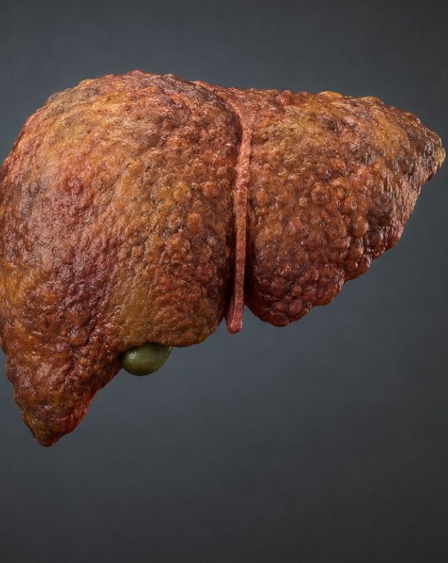 Liver Disease Symptoms In Hindi-1-2-3-4-5-6-7