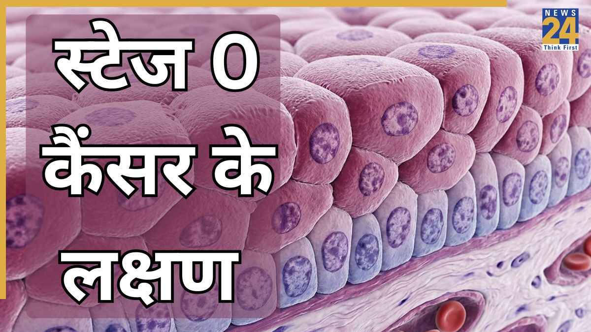 What Is stage 0 cancer