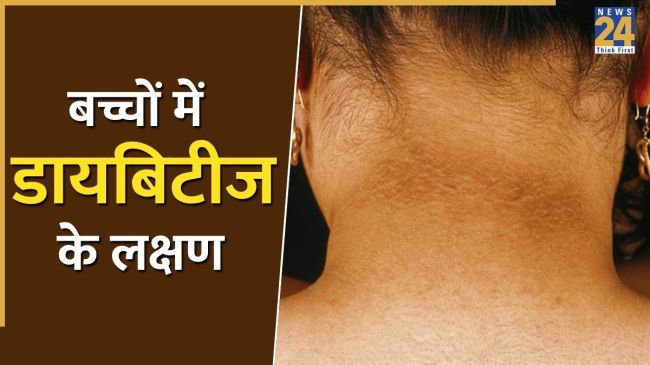 Diabetes In Children Signs Diabetes In Children Signs-1
