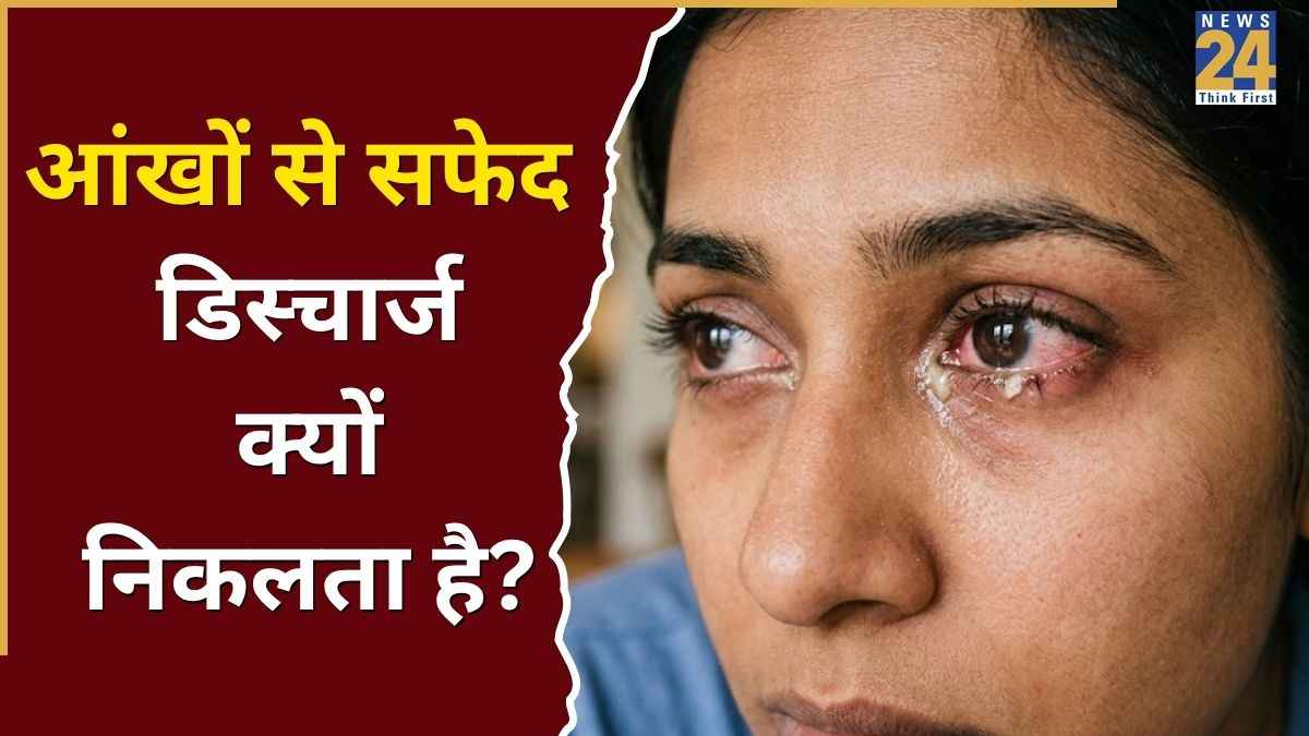 गर्मी में आंखें लाल रहती हैं? इग्नोर किया तो जा सकती है रोशनी, तुरंत चेक करें ये 5 लक्षण