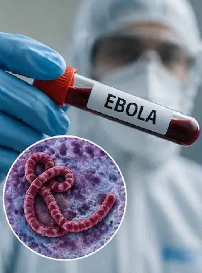 युगांडा में इबोला से पहले भी मरे 11000 लोग