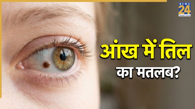 Eye-Mole