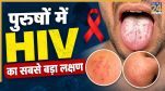 HIV Symptoms In Men