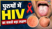 HIV Symptoms In Men
