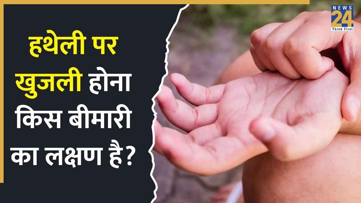 Itchy Palm liver disease