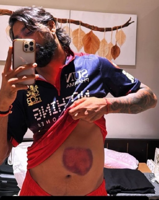 Krunal Pandya-1-2-3-4