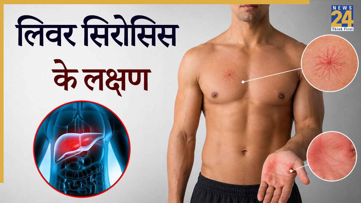 लिवर सिरोसिस का पता कैसे चलता है? जानिए Liver Cirrhosis में कैसे लक्षण नजर आते हैं