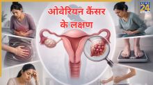 Ovarian cancer Symptoms