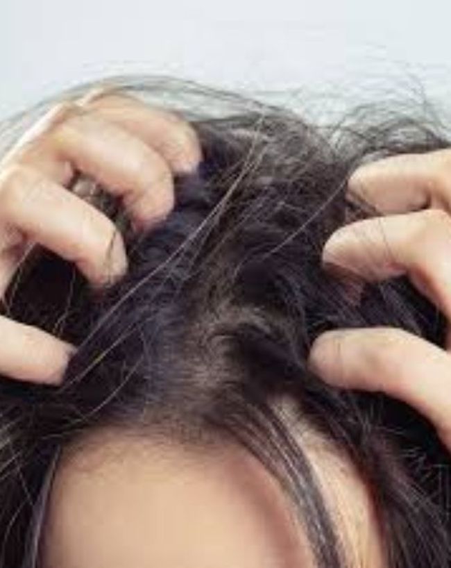 Why is my head so itchy at night-1-2-3-4
