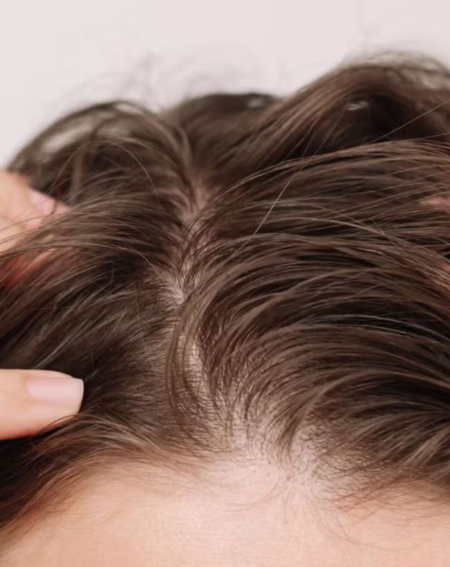 Why is my head so itchy at night-1-2-3-4-5-6