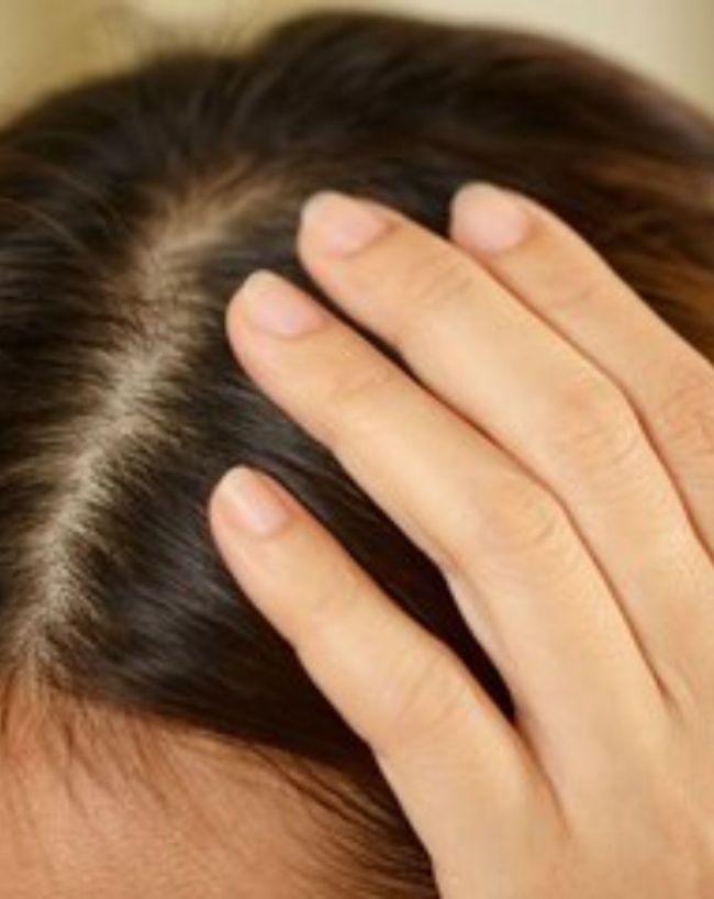 Why is my head so itchy at night-1-2-3-4-5