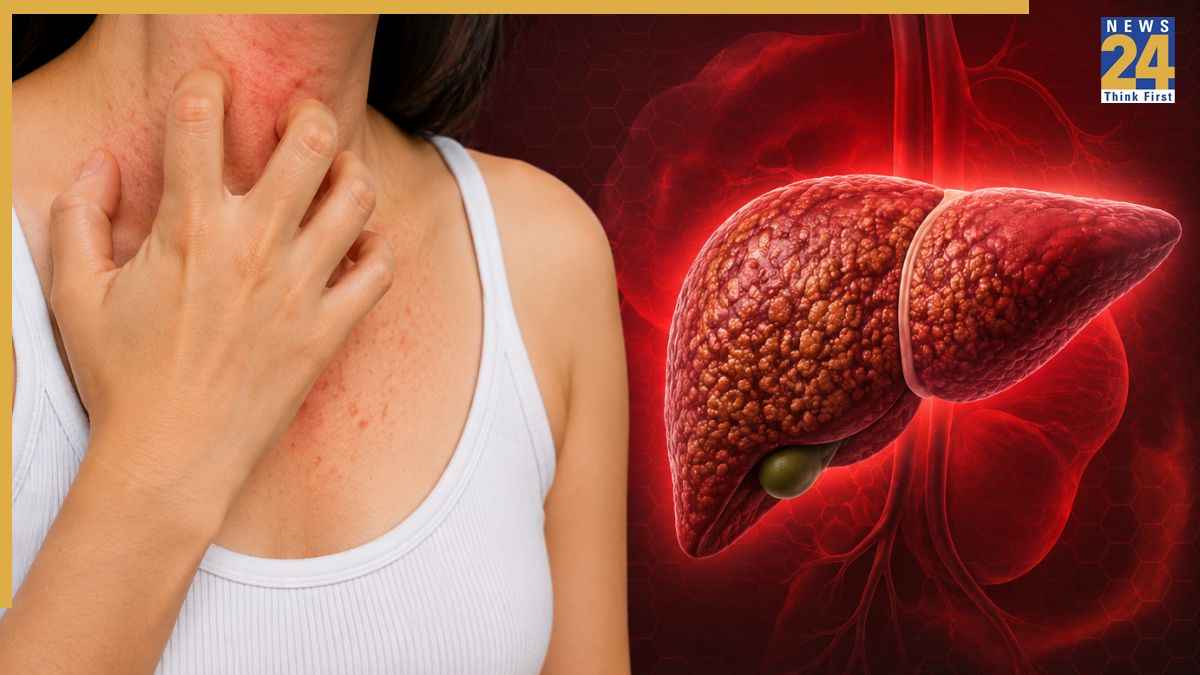 स्किन में खुजली के साथ दिख रहे हैं ये 5 संकेत? लिवर सड़ने का हो सकता है इशारा