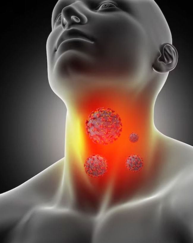 throat Infection-1-2-3-4-5