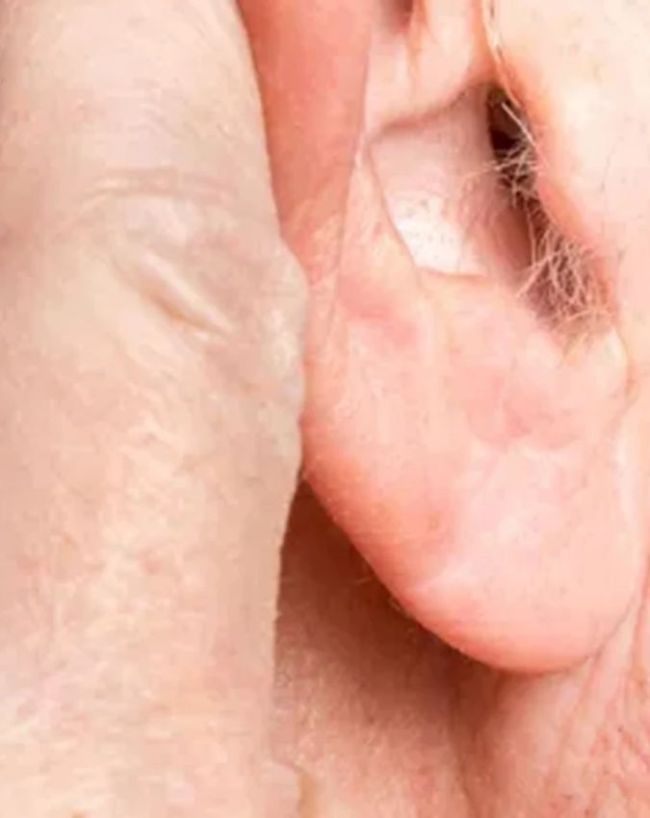 ear hair cutting side effects-1-2-3-4-5