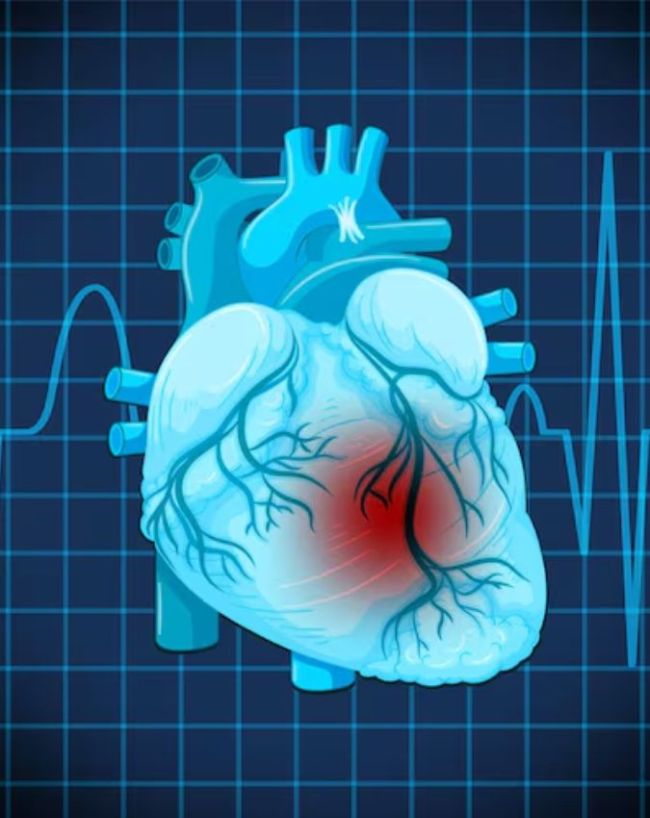 Heart Attack Signs Heart Attack Signs-1-2