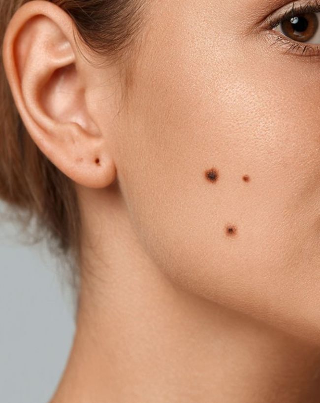 Throat Mole Infection-1-2-3-4-5-6