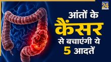 Colon Cancer