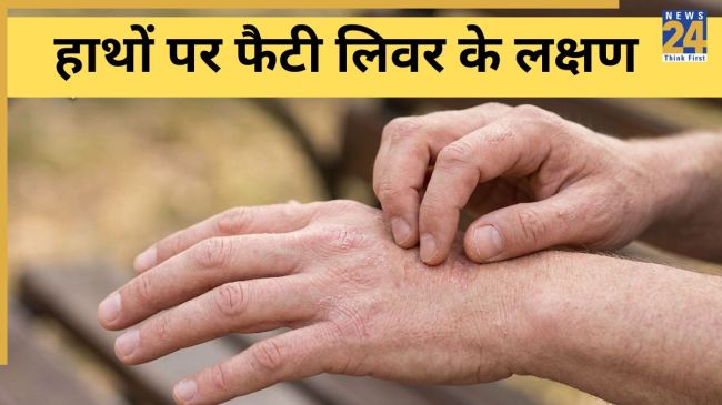 Fatty Liver Symptoms In Hindi