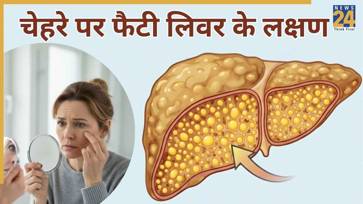 Fatty Liver Symptoms In Hindi