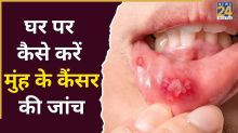 Oral Cancer