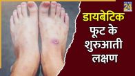 Diabetes foot symptoms in hindi