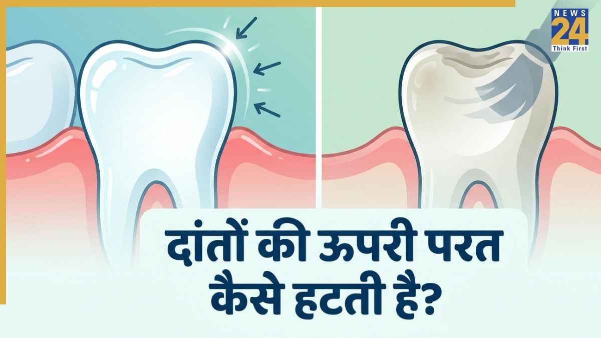 दांतों की ऊपरी परत क्यों जरूरी है? जानिए किन कारणों से हट जाता है Teeth Enamel