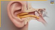 what is ear infection